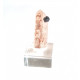 quartz and anatase